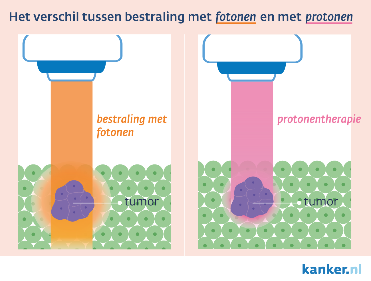 Hoe werkt protonentherapie?